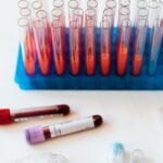 Know Your Numbers: Blood Pressure, Blood Sugar and Cholesterol